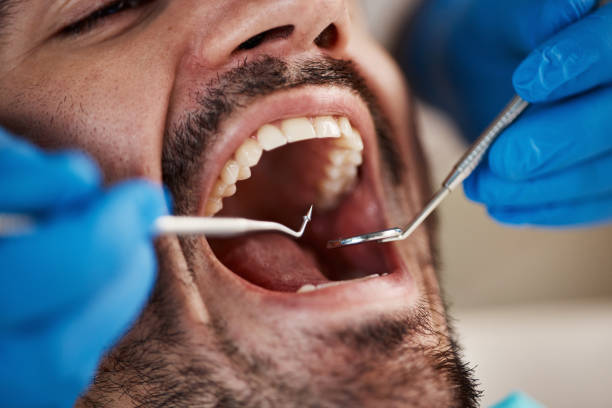 Best Oral Cancer Screening  in Black Canyon City, AZ